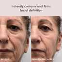 Laduora Lumeo 4-in-1 SkinLift Beauty Device + Serum Kit | Pro Glow System for Face & Neck