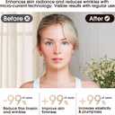 Face & Neck Massager | White LED Red-Light-Therapy-for-Face and Neck, Red Light Therapy Wand, 3 Color Led Massager for Skin Care