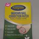 Ingrown Toenail Treatment Kit, Titanium Alloy Ingrown Toenail Removal Kit, Nails Corrector Tool & Remover Strips - Ingrown Toe Nail Quick Relief (0.67-0.79 Inch)