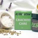 Cracked Skin Care Cream 1oz