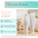Avne Cicalfate+ Absorbing Soothing Spray to dry and restore irritated, sensitive skin, helps restore skin barrier, safe for infants, children and adults