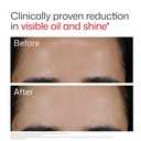 EltaMD UV Clear Face Sunscreen, Oil Free Sunscreen for Sensitive Skin with Zinc Oxide, Dermatologist Recommended