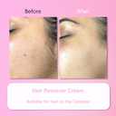 Hair Remover Cream for Face, 15 Minutes - Facial Hair Removal for Women, Hair Removal Trilogy Kit for Coarse, Fine and Stubborn Hairs, Removes Hair from Chin, Upper Lip & Sideburns (1 Set)