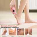 Electric Foot Callus Remover Tool: Rechargeable Foot File Callus Remover for Women Men, Professional Electronic Feet Grider for Cracked Dead Skin Home Salon (Pink)
