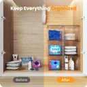 A-LuGei  Acrylic Stackable Storage Drawers, 11.8" L Makeup Organizer, Bathroom Organizer and, Under Sink Organizer, Plastic Storage Bins