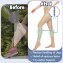 )+MD 140D Light Compression Pantyhose for Women, 15-20mmHg Graduated Compression Tights, Footless Leggings for Leg Support  (S/M)