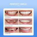 Snap-On Veneers - Professional DIY Smile Correction Kit for Men & Women - Comfortable, Natural White Top & Bottom Set - Perfect for Hiding Gaps, Stains & Missing Teeth - Easy Home Fit