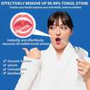 Upgraded Electronic Tonsil Stone Remover10 in 1 Tonsil Stone Removal KitTonsil Stone Vacuum with Built-in Blue LightEasy to Use, Fight Bad Breath, Instant Suction (White)