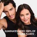 VICHY Dercos Dandruff Shampoo, Antifungal Dry Scalp Treatment & Itchy Scalp Relief, Prescription Strength Selenium Sulfide Comparable to 2% Ketoconazole, For Mild to Severe Dandruff & Flaky Scalps