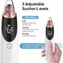 Blackhead Remover Pore Vacuum for Face and Nose, Facial Pore Cleanser with 3 Suction Levels, 5 Replaceable Tips, USB Rechargeable Tool for Blackheads and WhiteheadsWhite