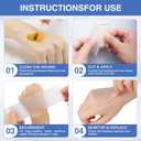 Hydrocolloid Roll for Wound Dressings,Medical Tape for Wound Care, First Aid Kit Essential,Extra Large Hydrocolloid Patch Gel Bandages with Self-Adhesive,Highly Absorbent for Burn, Blister, Acne Care