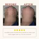 Facial Hair Removal Cream Kit for Women Face Sensitive Skin with Calm Cream, Painless Facial Depilatory Cream for Face Chin Lip Fuzz, 4 Mins Hair Remover At Home, 2.37 fl.oz w/Spatula