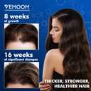 5% Minoxidil Hair Growth Spray for Women and Men, Effective Anti-Hair Loss Treatment for Regrowth, Extra Strength Scalp Solution, Thicker, Stronger and Longer Hair - 60ml