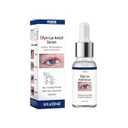 Stye Eye Treatment, Stye Relief Serum | for Chalazions and Blepharitis, Eyelid Bumps, Non Irritating Formula, Quickly Soothe (1 Fl Oz (Pack of 1))