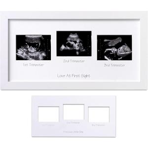 eletecpro Triple Ultrasound Picture Frame, Display 34 Sonogram Photo, Keepsake Frame for Pregnancy Announcements, Expecting Parents, Baby Shower, Gender Reveal Party, Baby Nursery Decor, White (15x8)