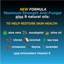 Fungi-Nail Anti-Fungal Liquid Solution, 1 Fl Oz (Pack of 1), Kills Fungus, Athletes Foot Treatment, Toe Nail Fungus Treatments w/Tolnaftate, Clinically Proven to Cure and Prevent Fungal Infection