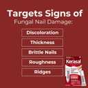Kerasal Nail Fungus Extra Strength | Restorative Nail Repair for Damaged Nails, 0.33 fl oz (Packaging May Vary)