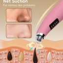 Pore Vacuum Blackhead Remover - Pore Extractor with 5 Attachments & 3 Suction Levels - Blackhead Remover Tools for Women and Men (Pink)