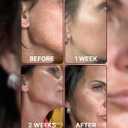 BeMe Liquid Collagen for Women - 2500mg Verisol Collagen Liquid with Biotin, CoQ10 & Vitamin C - Clinically Proven Collagen Peptides for Hair, Skin & Nails - 15 Mixed Berry Sachets