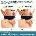 2 x Silicone Scar Tape - 60" x 1.6" Roll - 1.5M, Scar Treatment for Improves Surgical, Keloid, Hypertrophic Scars - Medical Grade Reusable Silicone Scar Sheets