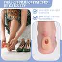 WILLBOND 48 Pack Callus Pads Soft 1/4" Thick Oval Shape Corn Pads 1/8" Felt Callus Cushions Adhesive Corn Protectors for Men Women Feet Toes Pain Relief(Nude, 1/4 Inch)