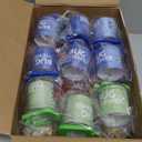 36 Pcs Insert Bug Viewer for Kids Magnifying Insect Box Bug Catcher Magnifier Container Critter Collection Kit Insect Cage Jar for Children Science Nature Exploration Tool