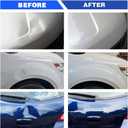 Car Dent Removal Kit, 35PCS Dent Puller, Paintless Dent Repair Kit with Double Pole Bridge Dent Puller for Auto Dent Removal, Minor dents, Door Dings and Hail Damage 