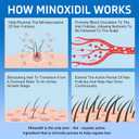 6 Pack 5% Minoxidil with Biotin, Hair Growth Treatment, Minoxidil Hair and Beard Growth Serum, Minoxidil for Men and Women, Supports Thicker and Fuller Hair & Beard (12 fl oz, 6 Month Supply)