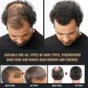 500 ml Root Activator Shampoo, Hair Growth Root Activator Shampoo, For Anti-Hair Loss, Natural Formula for Men and Women