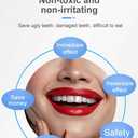 Snap-On Veneers - Professional DIY Smile Correction Kit for Men & Women - Comfortable, Natural White Top & Bottom Set - Perfect for Hiding Gaps, Stains & Missing Teeth - Easy Home Fit