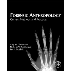 Forensic Anthropology: Current Methods and Practice, Hardcover