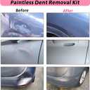 Car Dent Puller, 8 Packs Dent Remover Tool for Car Dent Repair, Versatile Suction Cups Puller with Strong Suction & Effortless Handle for Auto Body, Glass, Fridge, Tile Lifting & Objects Moving