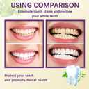 Tooth Refresh Toothpaste, Fresh Breath Whitening Toothpaste, Natural Oral Care & Enamel Repair, Helps Remove Coffee, Tea & Wine Stains, 3.52 oz (1)