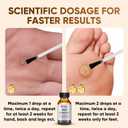 4pcs  "STAY STOKED" Wart Remover, 15ml Fast-Acting Wart Freeze Off with Natural Herbal Extracts - Gentle Yet Powerful for Common Warts, Plantar Warts on Hands/Feet-0123