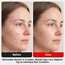 Led-Light-Therapy 7-in-1 LED Light Beauty Device Skin Body