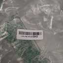 XINDAM 6X Enlarged Human Eye Anatomical Model - Accurate Anatomy for Science Classroom Study, Display, Teaching Medical Model