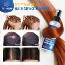 Minoxidil for Men and Women Hair Growth: 5% Minoxidil Topical Spray Hair Regrowth Treatment Stop Hair Thinning and Hair Loss For Stronger Thicker Longer Hair 60ml 2 Pack