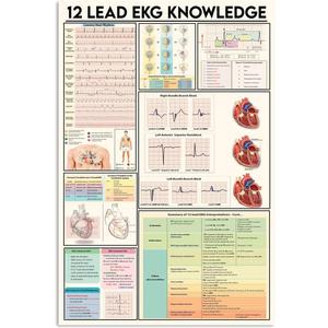 JIUFOTK 12 Read Ekg Knowledge Metal Signs Vintage Office Decor Doctor Science Guide Tin Poster Home Clinic Wall Decoration Plaque 16x24 Inches