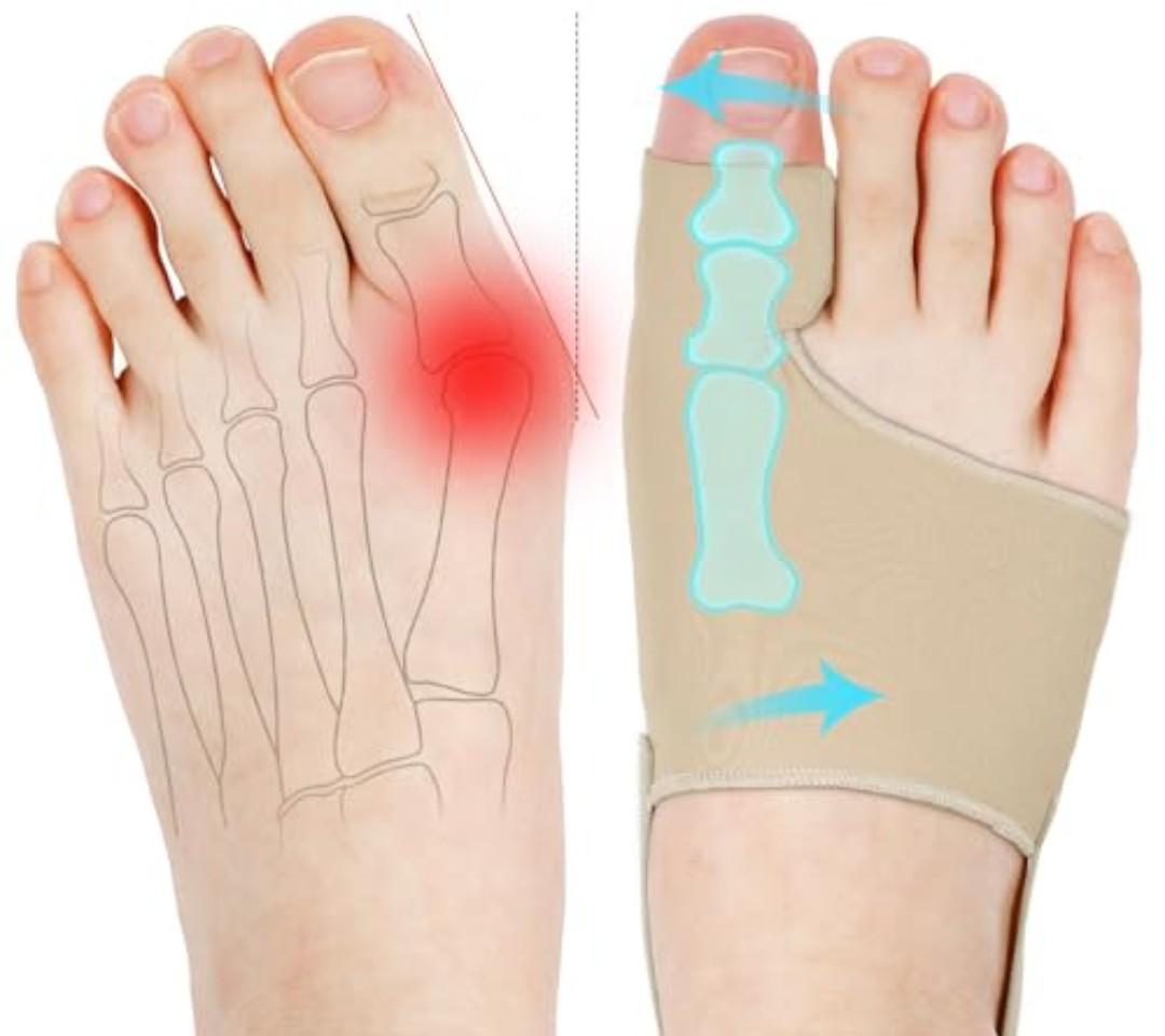 KTSAY 2PCS Bunion Corrector for Women & Men, Big Toe Straightener with Splint & Pads, Comfortable & Breathable for Day/Night Support, Hallux Valgus Pain Relief Non-Slip Socks