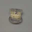 Ultrassist Transparent Disease Teeth Model with Dental Implant Bridge, Dental Model for Patient and Dental Student Education