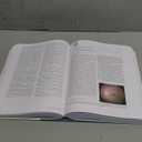 Genetic Diseases of the Eye (Oxford Monographs on Medical Genetics)