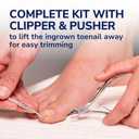 Dr. Scholl's INGROWN TOENAIL PAIN RELIEVER & TRIMMING KIT, 0.3 oz // Only OTC Treatment Proven to Relieve Ingrown Toenail Pain - Includes Medicated Gel + Foam Rings + Bandages + Clipper & Pusher Tools