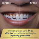 Waterpik Sensonic Complete Care Water Flosser and Rechargeable Electric Toothbrush Combo Set for Teeth Cleaning and Flossing, CC-04, White