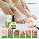 Ginger Nail Treatment, Ginger Cuticle Care Oil for Nails, Strengthen Nails, Ginger Nail Treatment Serum, Promote Nail Growth, Natural Plant Formula 30ml