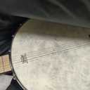 AKLOT 5-String Banjo Deluxe Set: 38-Inch Full-Size Banjo With Remo Head and Detachable Resonator, Open-Back or Closed-Back Playing, With Pickup, Tuner, Bag, Strap, Pick, Bridge, for All Adult Levels