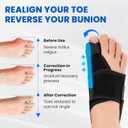 Bunion Corrector and Ice Pack (2+1 Set) Bunion Corrector For Women Big Toe and Men, Hallux Relief Splint, Big Toe Straightener