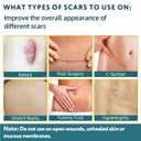 Silicone Scar Tape - 60" x 1.6" Roll - 1.5M, Scar Treatment for Improves Surgical, Keloid, Hypertrophic Scars - Medical Grade Reusable Silicone Scar Sheets