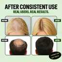 Hair Grow Hair Growth Spray for Women and Men, Natural Thickening Treatment for All Hair Types, Promotes Fuller Hair,50ml