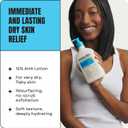 AmLactin Intensive Healing Body Lotion - Therapeutic Lotion for Extremely Dry Skin - No-Scrub Exfoliator and Moisturizer with 15% Lactic Acid AHA and Ceramides, 14.1 oz