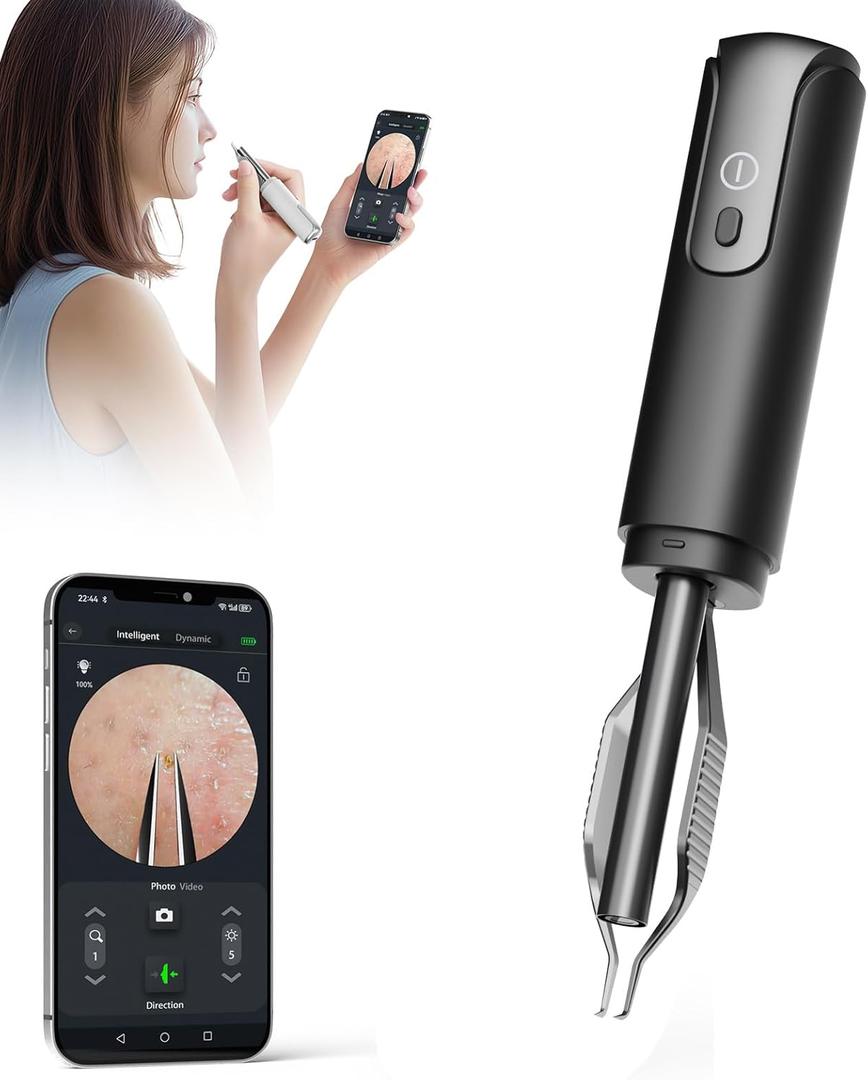 Blackhead Removal Tweezer with 1080p Camera, Ultimate Precision: Blackhead Removal with Camera - Perfect for Delicate Tasks! - - Ingrown Hair, Ear Hair Tweezer (Black)
